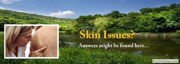 SkinIssues