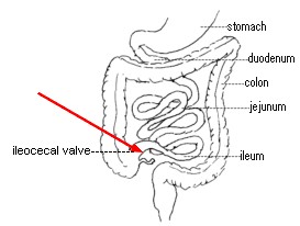 Ileo Cycle Valve