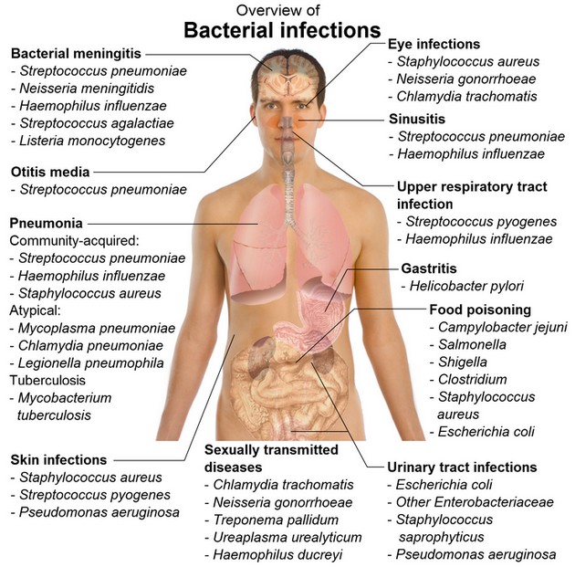 Bacterial Infection