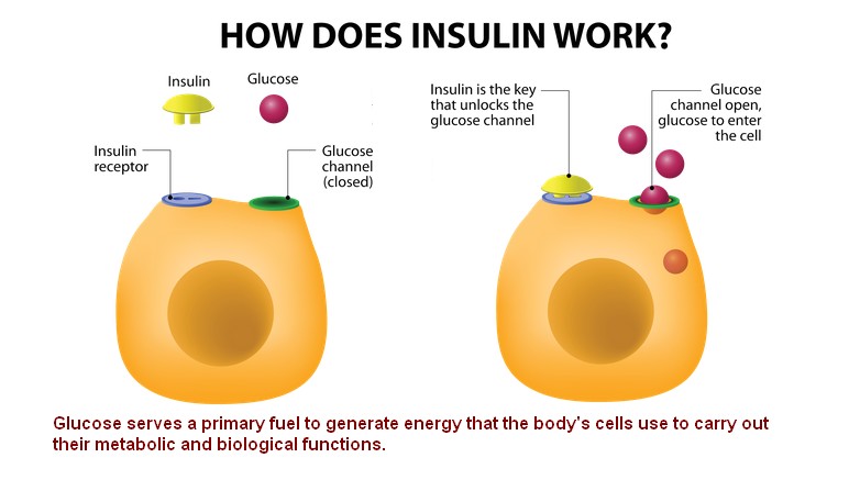 Metabolic Syndrome Hyperinsulinemia Syndrome X