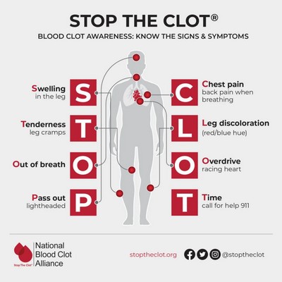 Blood Clots