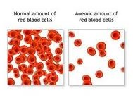 Anemic Blood