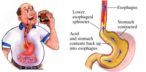 can calcium carbonate cause stomach problems